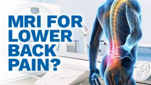 MRI-for-Back-Pain